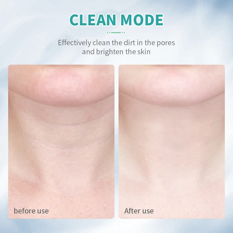 GlowLift™ Neck & Face Firming Tool – EMS & LED Rejuvenation