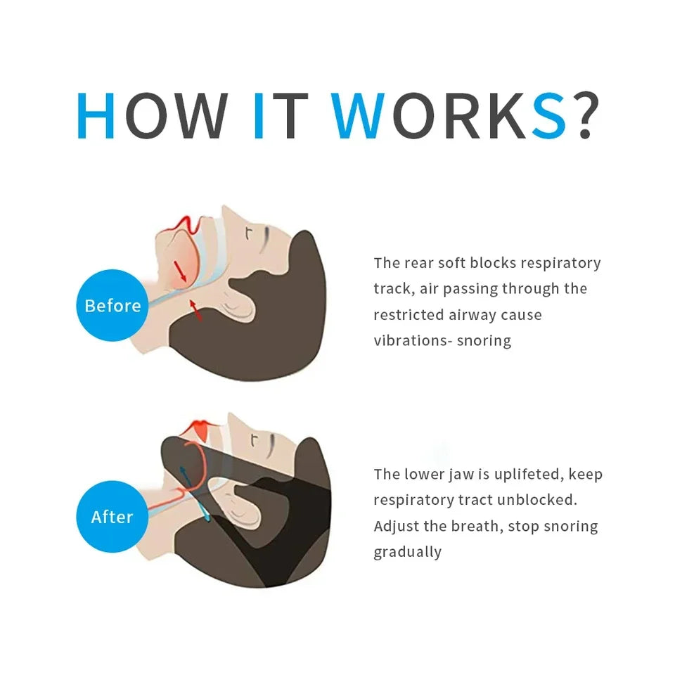 SnoreFree™ Comfort Strap - Natural Snoring Relief for Deeper, Undisturbed Sleep